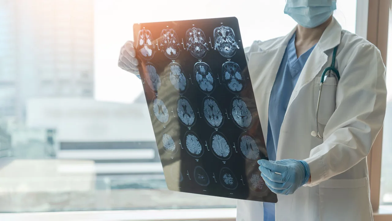 Toolbox Talk - Traumatic Brain Injury